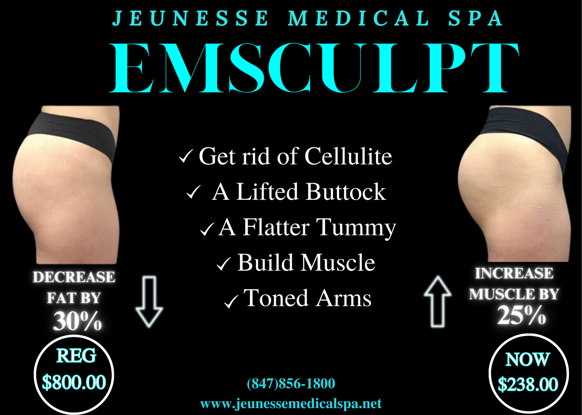 Emsculpt: - Build Muscle &amp; Sculpt Your Body