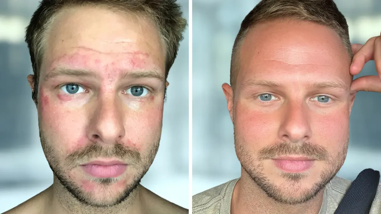 My Simple, Science-Backed Skincare Routine That Actually Healed My Skin