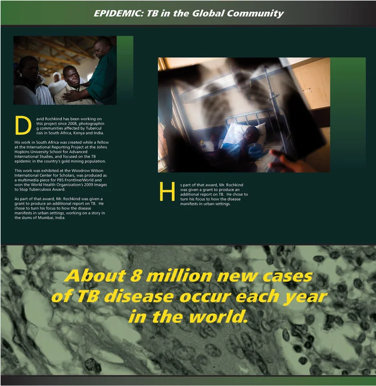 Museum panels for tuberculosis photo exhibition