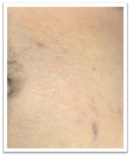 3-treatments-after.jpg