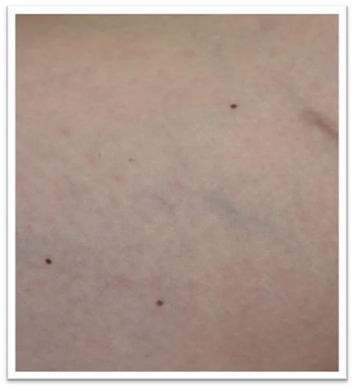 10-WEEKS-2-TREAT-AFTER.jpg