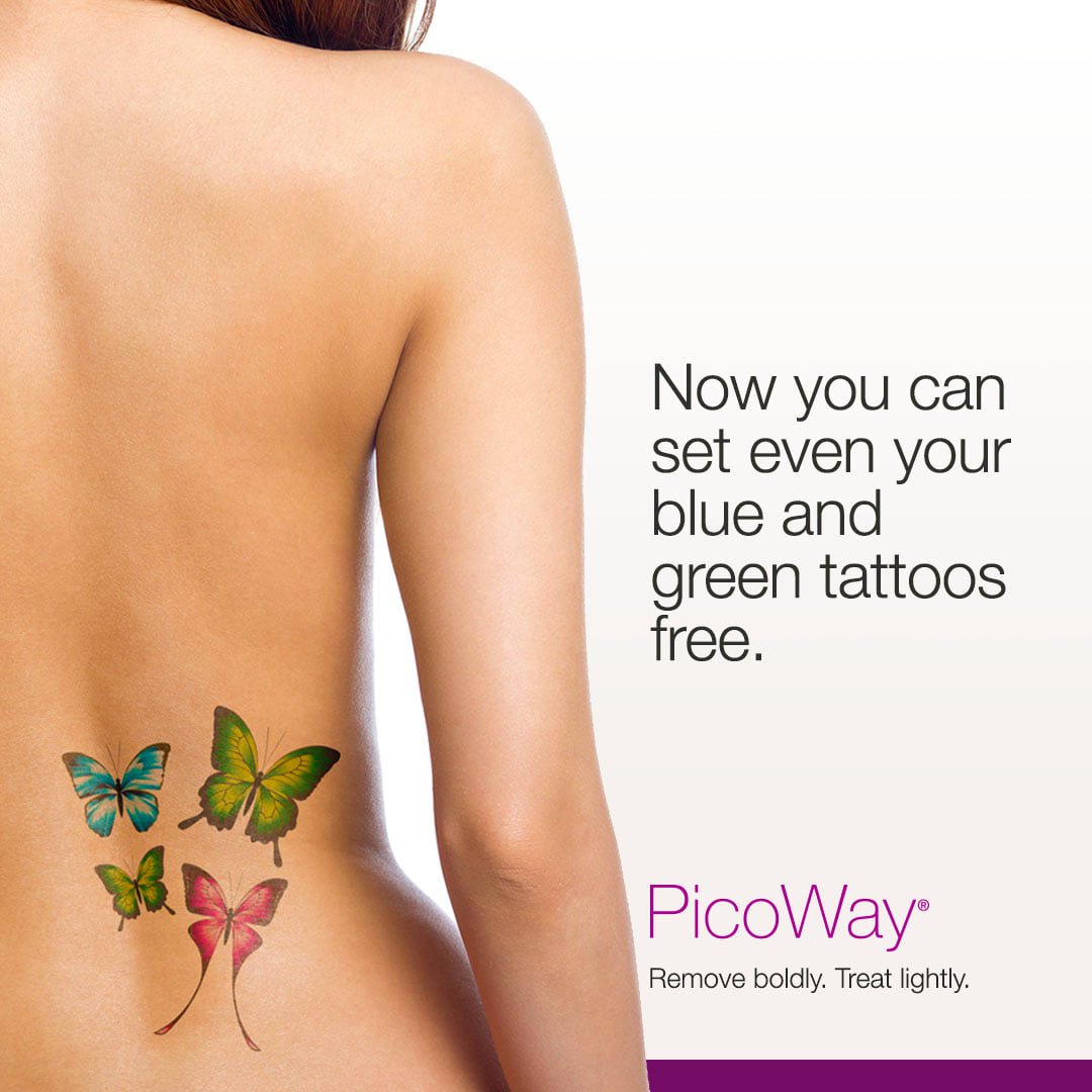 Laser Tattoo Removal In Cork — Shirley's Beauty & Laser Clinic