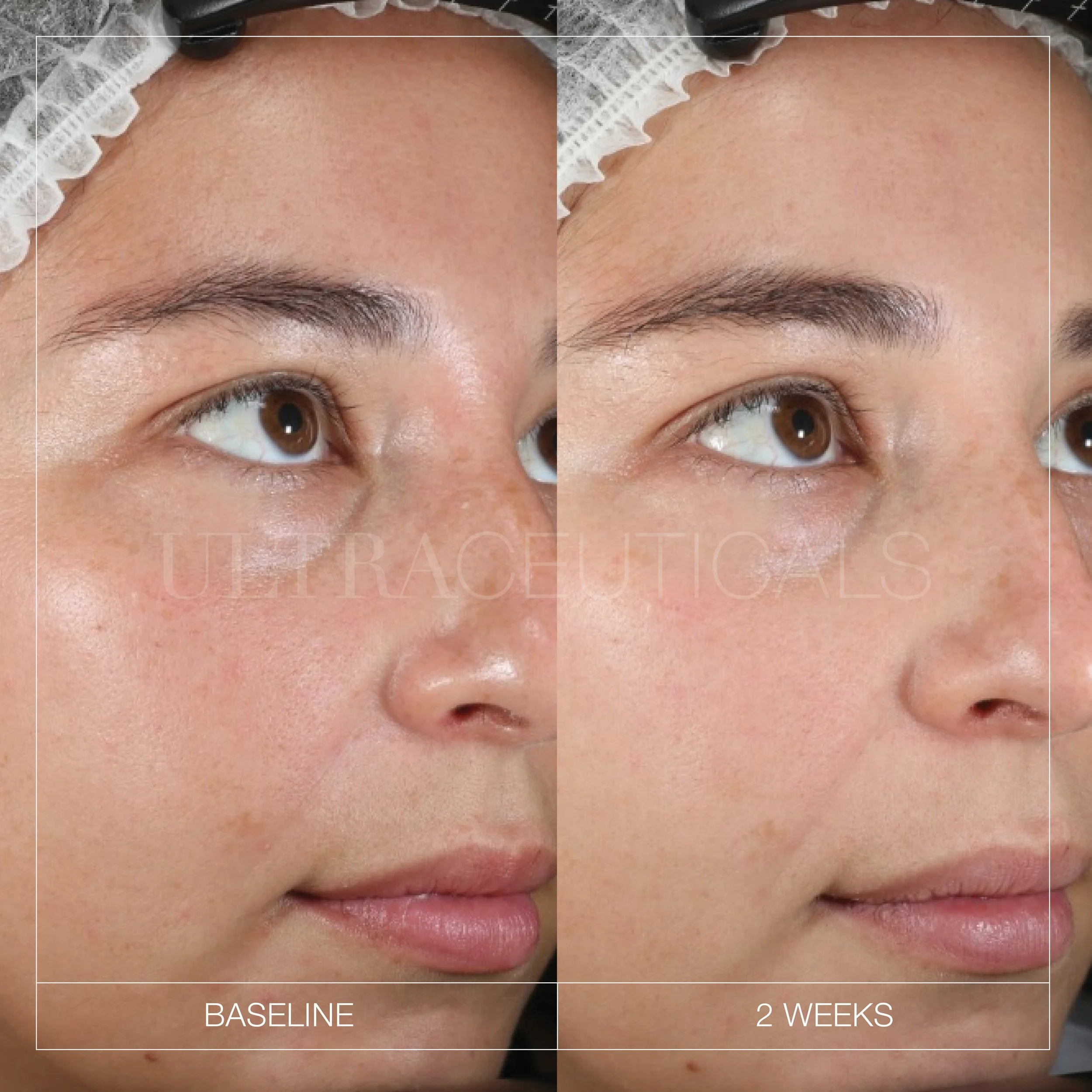 Brightening-Serum_Social-Tiles6.jpg