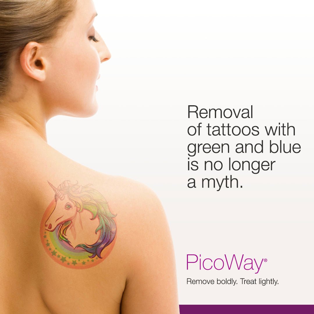 Laser Tattoo Removal In Cork — Shirley's Beauty & Laser Clinic