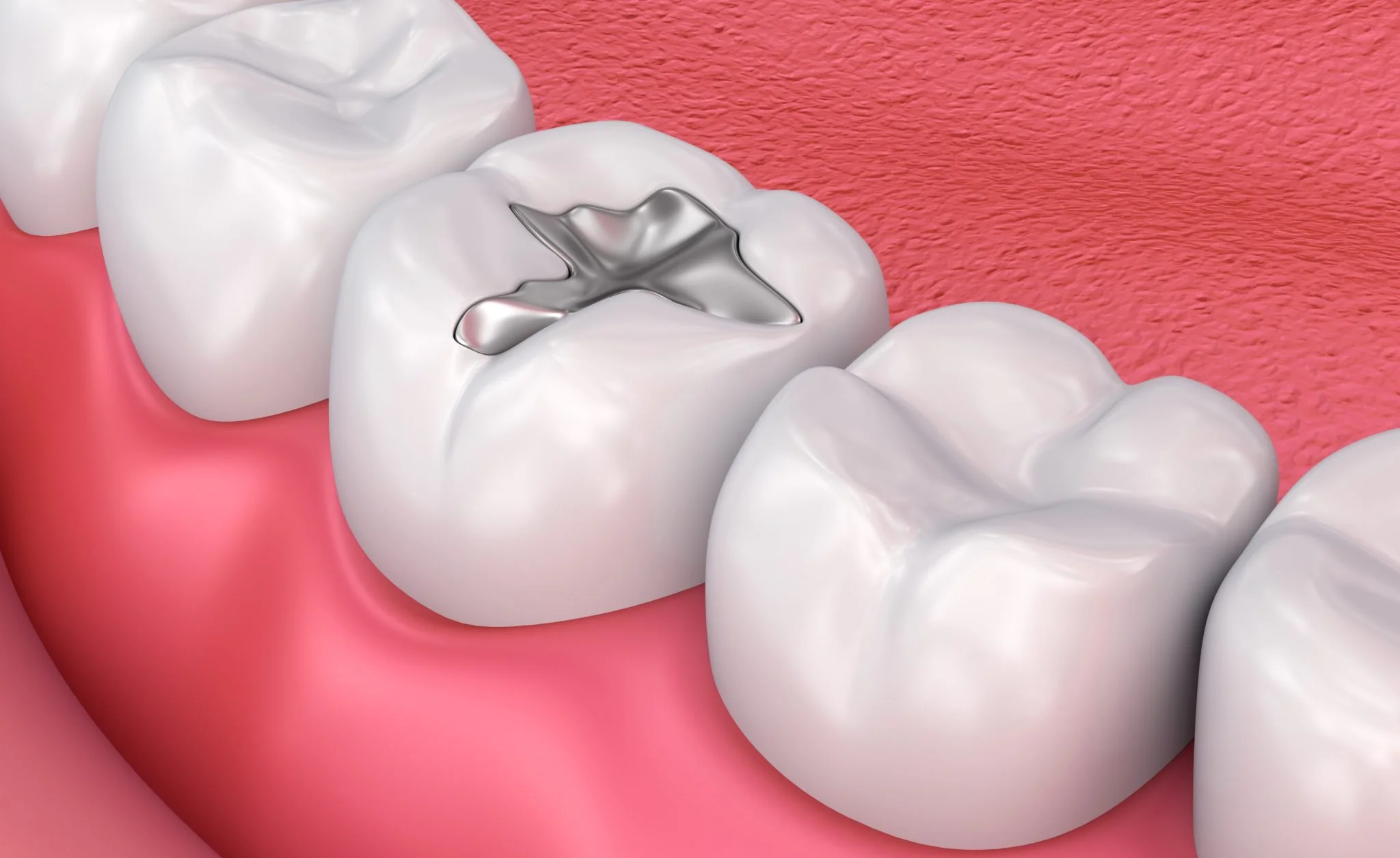 education-dental-filling.jpg