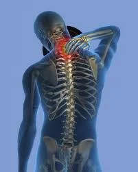 Spinal Cord Injuries