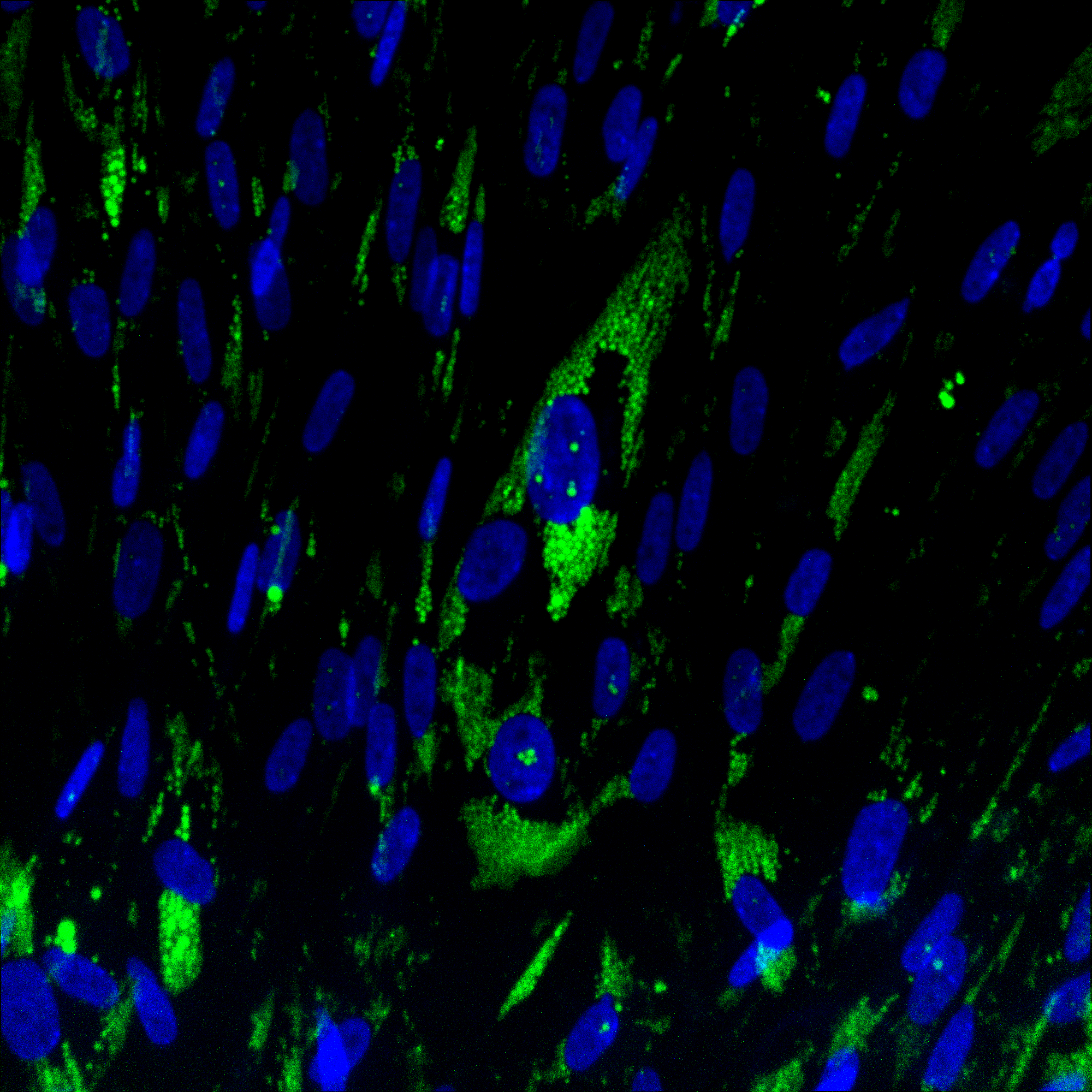  ObaCell imaged on Yokogawa CQ1 confocal high-throughput imaging system. 