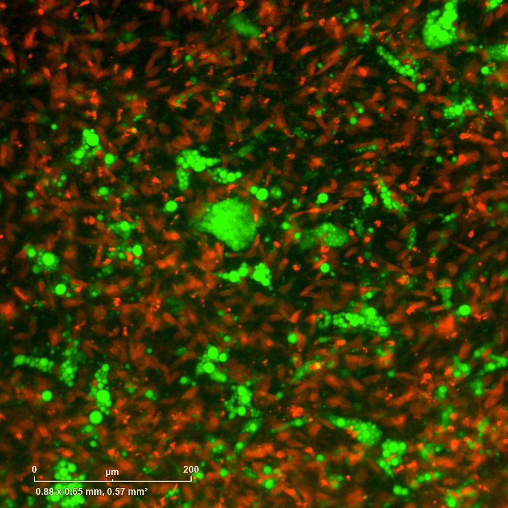  ObaCell imaged on Sartorius Incucyte high-throughput imaging system. 