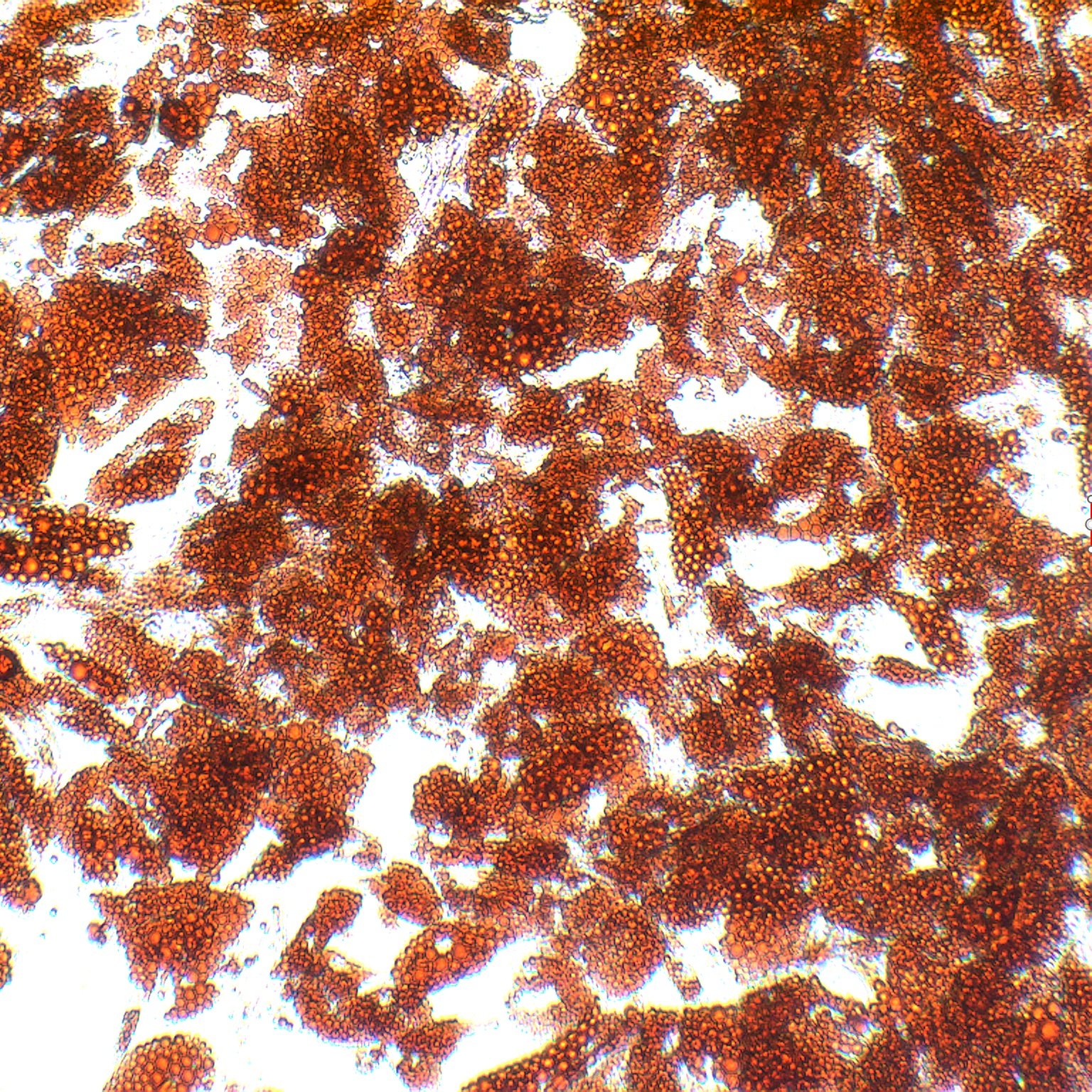 Adipose-derived stem cells differentiated into pre-adipocytes with AdipoQual. Lipids stained with Oil Red O. 