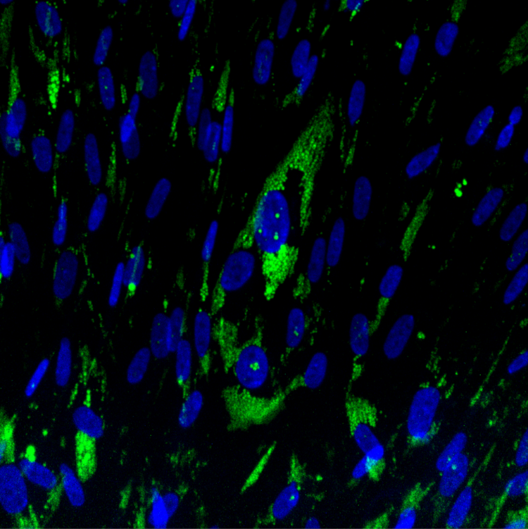 ObaCell imaged on Yokogawa CQ1 confocal high-throughput imaging system.