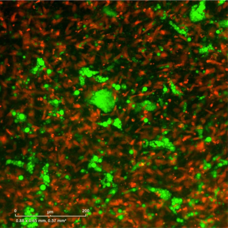 ObaCell imaged on Sartorius Incucyte high-throughput imaging system.