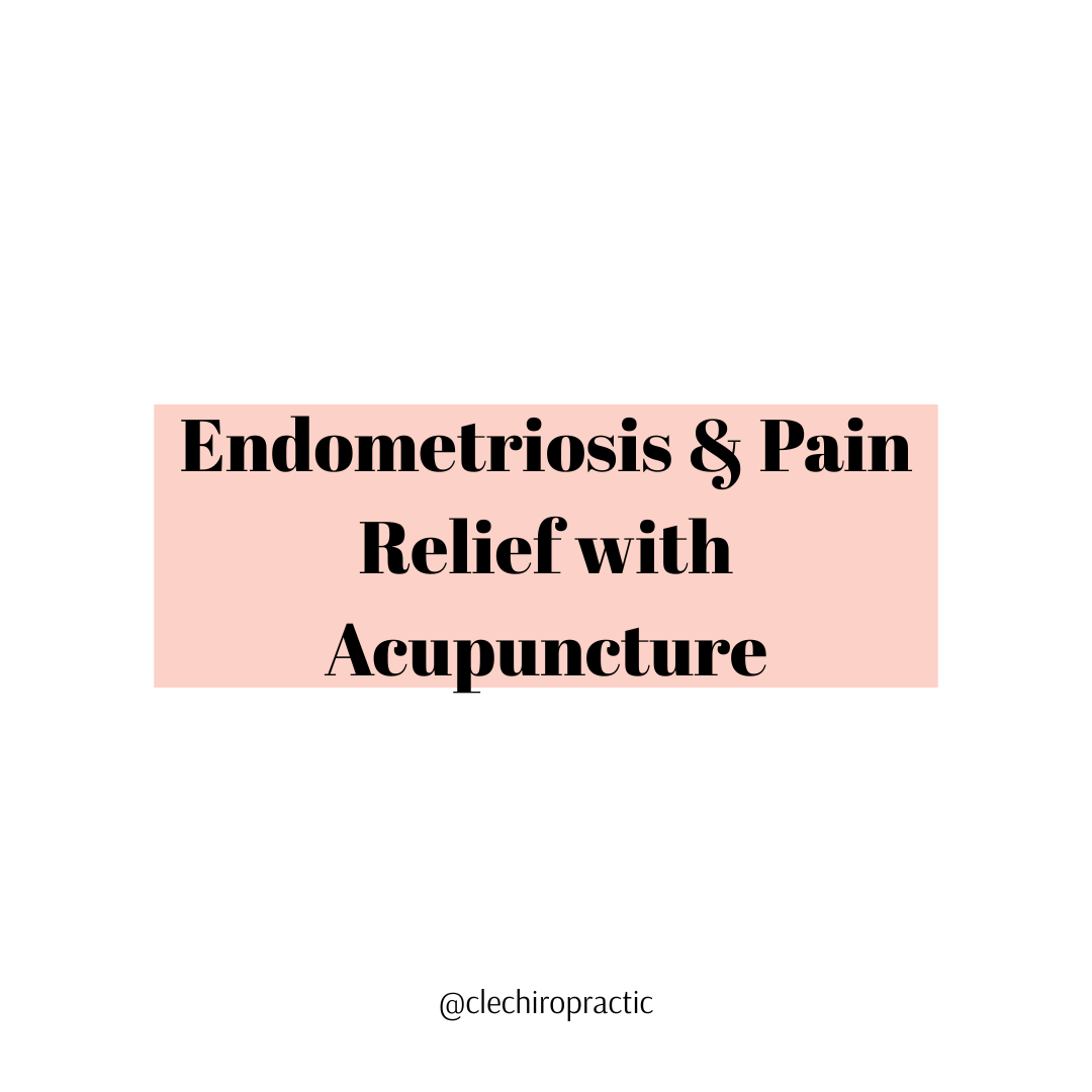 Endometriosis &amp; Pain Relief with Acupuncture