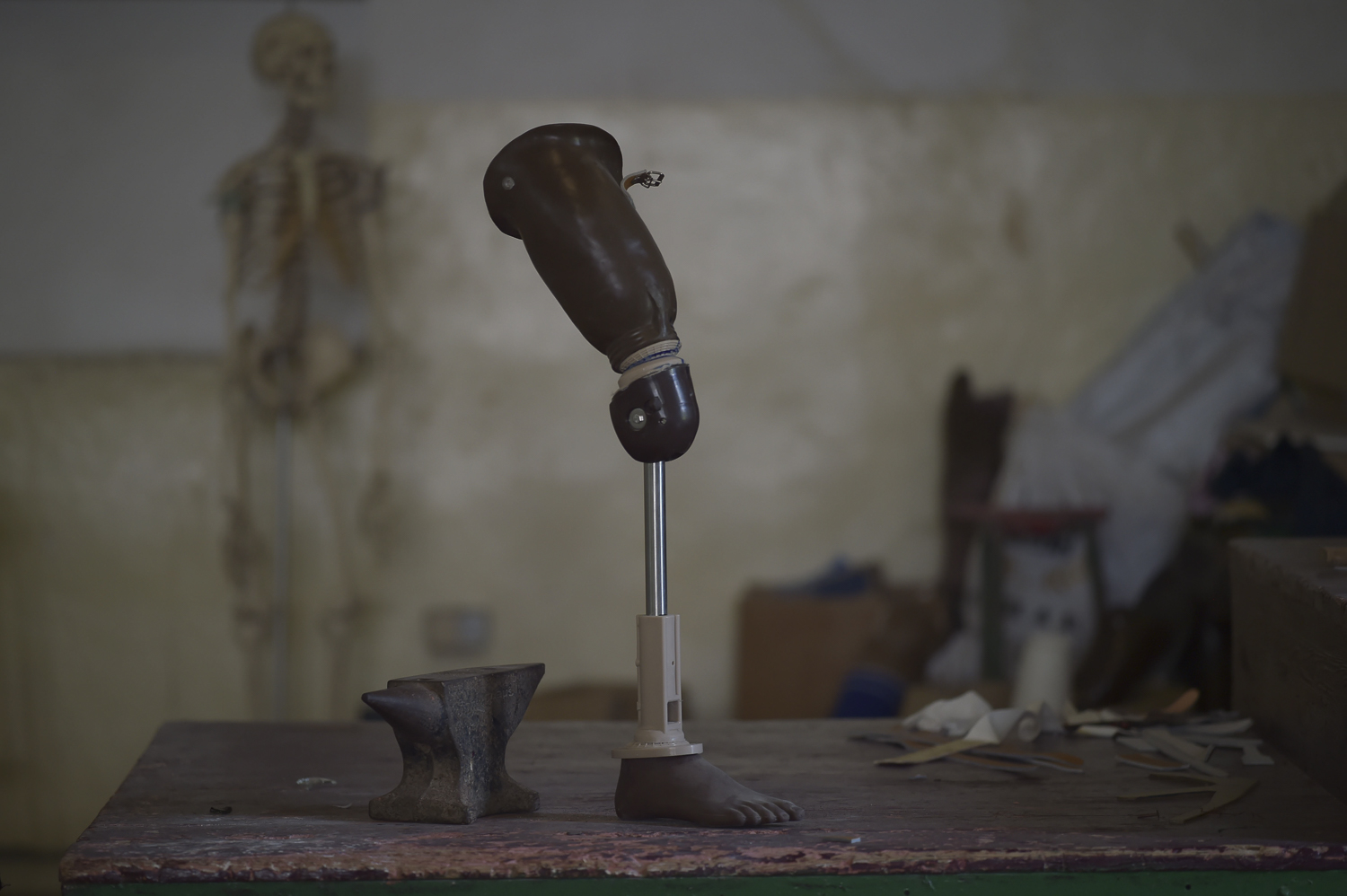 A slightly older version of the center's prosthetic leg on display. Almost all of the center's building of prosthetics is done on site, from creating a mold of the patient's limb, to casting the replacement, and assembling the finished product.