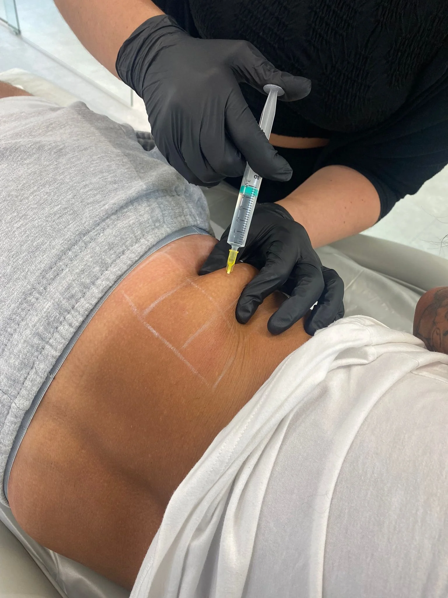 Combined Fat Dissolving Training | Aesthetics Lounge Academy ...