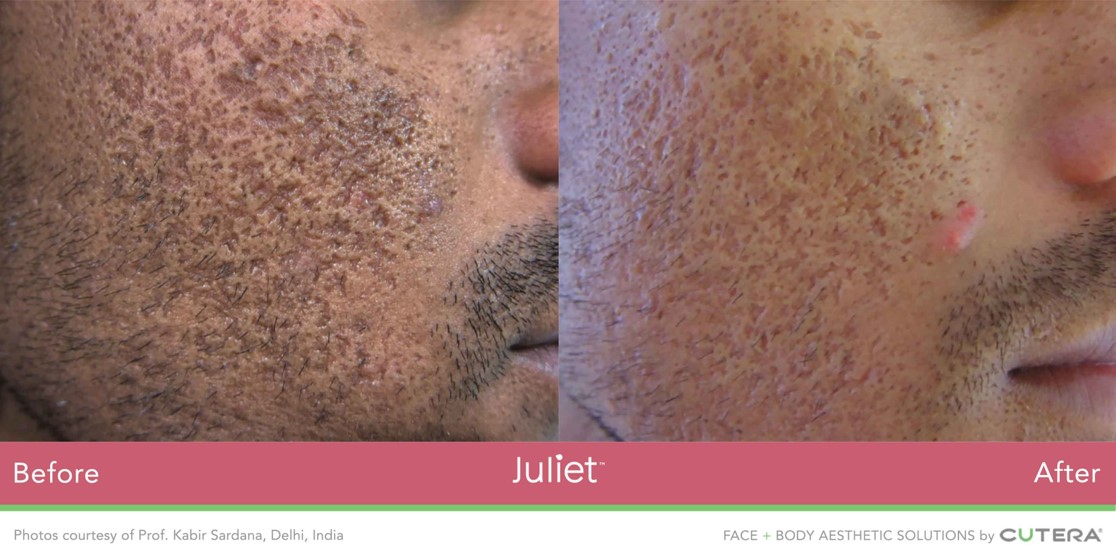 Juliet-Face-man.jpg