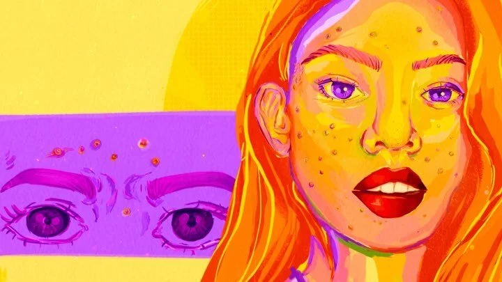 timelapse of my painting and my acne recovery
.
#procreate #illustration #artistsoninstagram #illustration #acne #pimples #acnepositivity #acnetreatment #acneproblems #skincare #normalizeacne #acneisnormal #painting #wip #sketch #mentalhealthawarenes