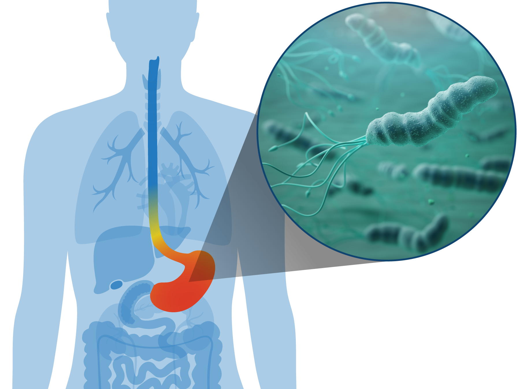Phathom-Website-PipelineIllustrations-HPylori-042619.png