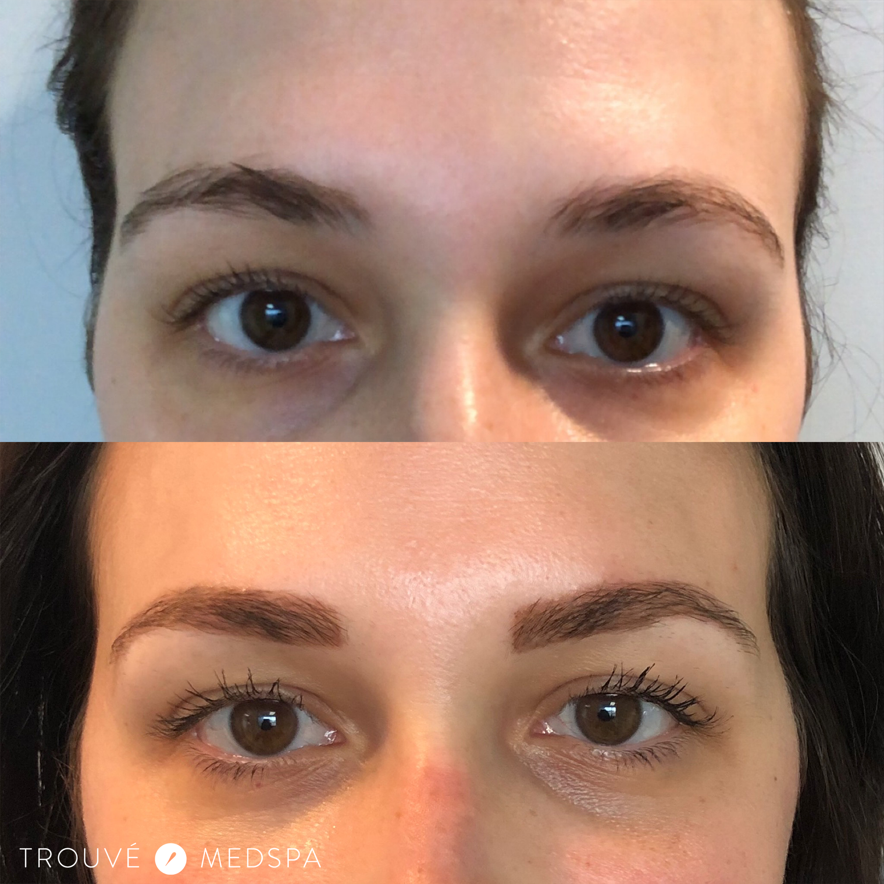 Trouvé Medspa Microblading Cleveland - Permanent Makeup Cleveland Ohio Trouvé Medspa Microblading Cleveland - Permanent Makeup Cleveland Ohio