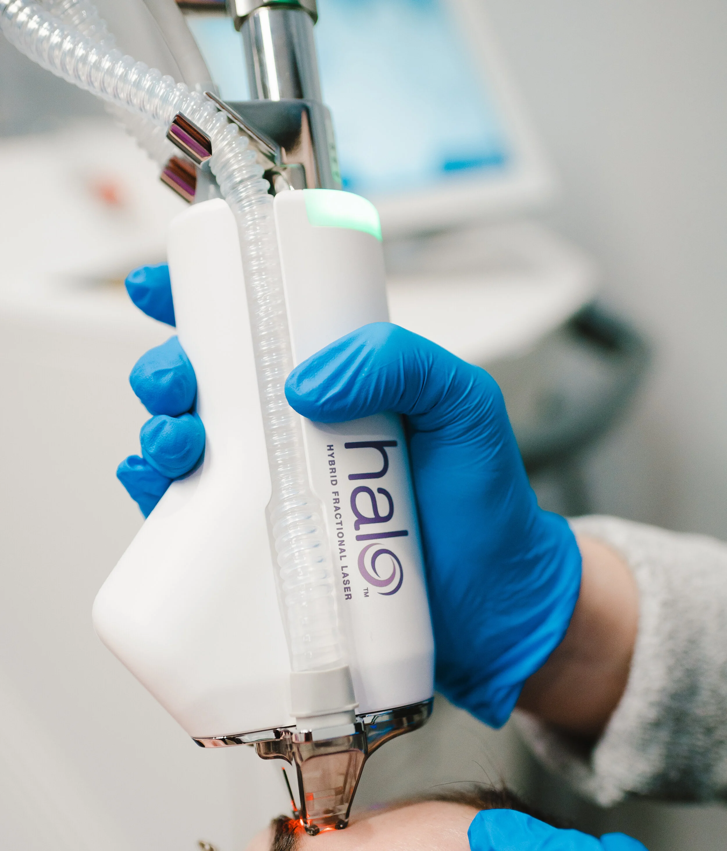 Trouv Medspa Halo Laser Resurfacing