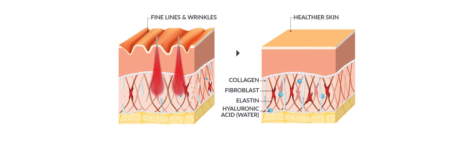 Treatment Graphic Transparent.png