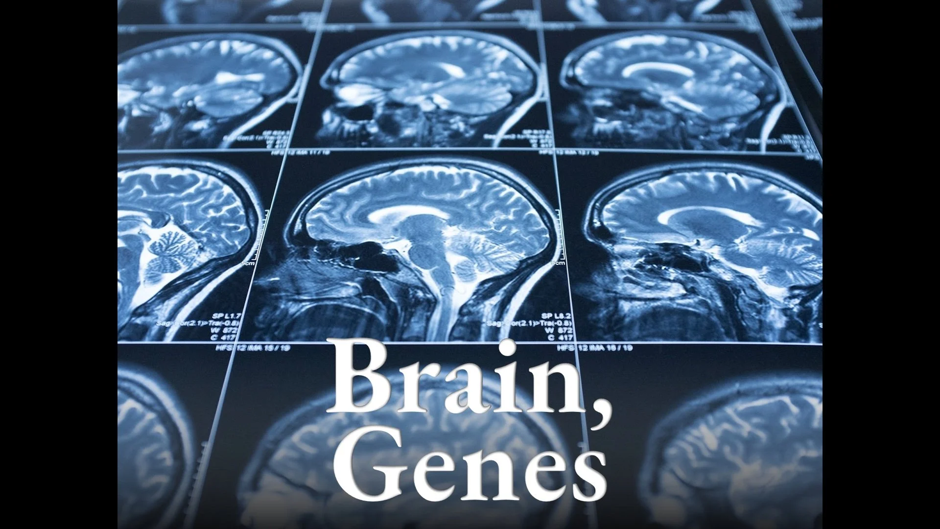 Brain, Genes