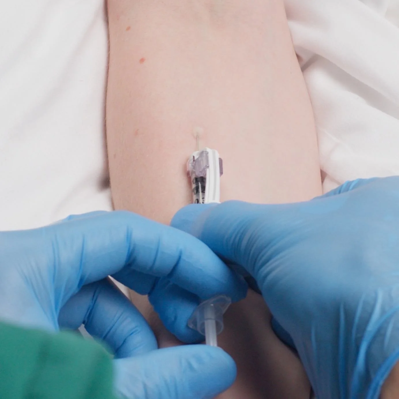 Pain Management - How to Start an IV Painlessly