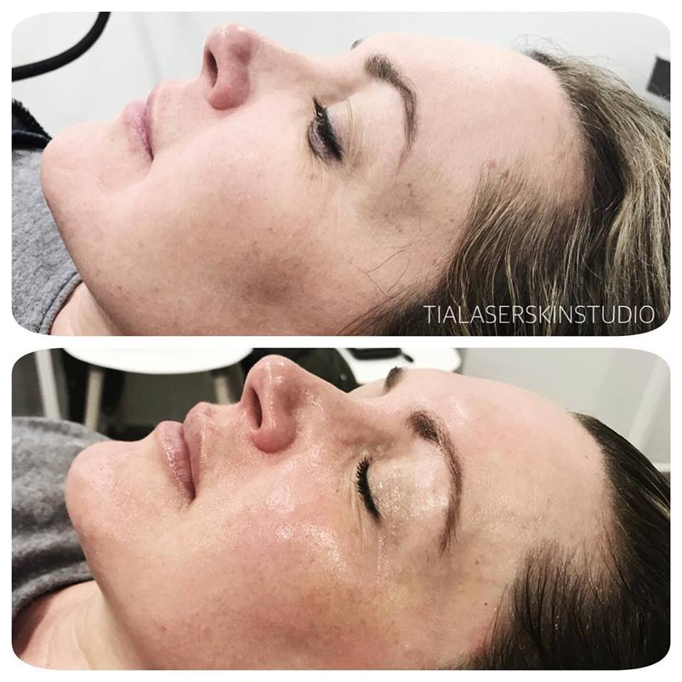 Bio-Hydraderm