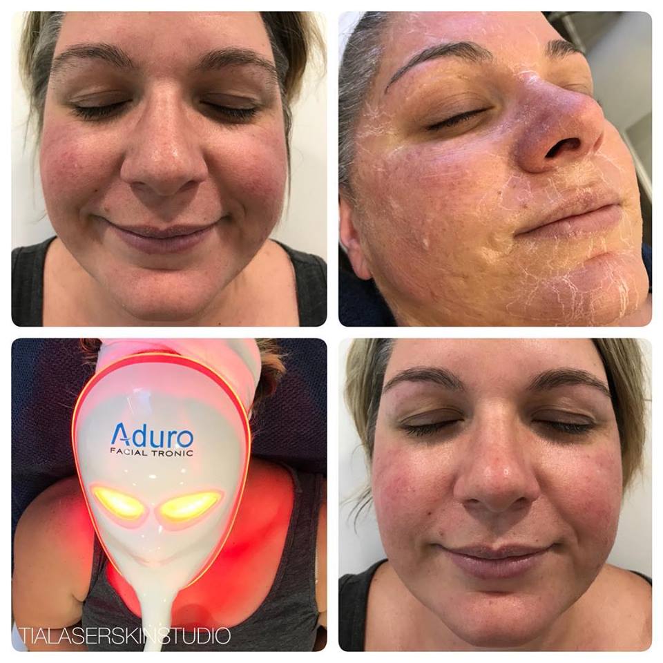 Custom Facial