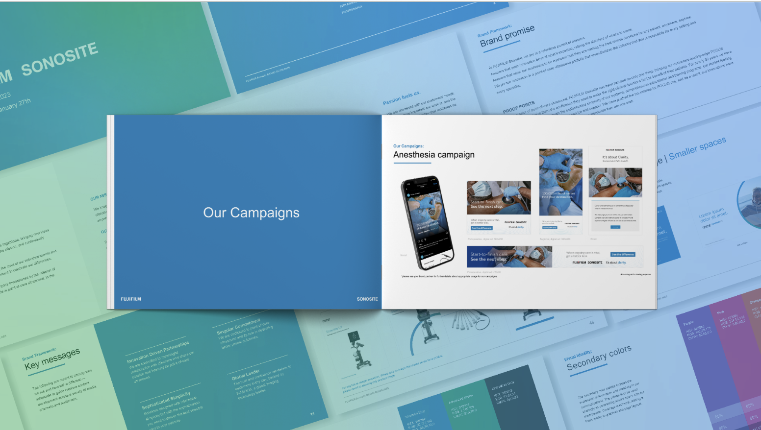  The Anesthesia campaign brings focus to what FUJIFILM Sonosite ultrasound systems are known for: uncompromising clarity and exceptional image quality. 