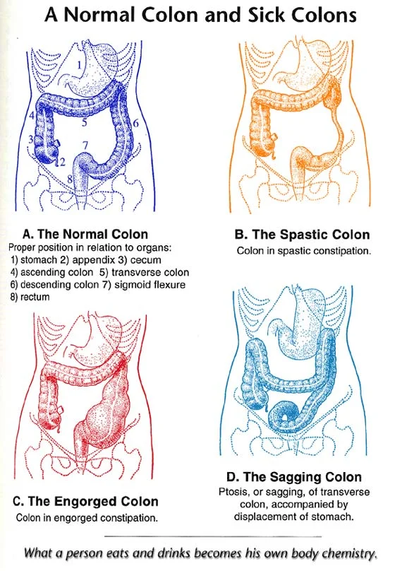 Colon-Normal-Sick.jpg