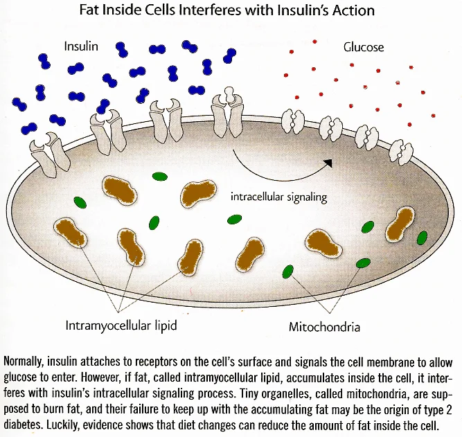 Intramyocellular-Lipids.jpg