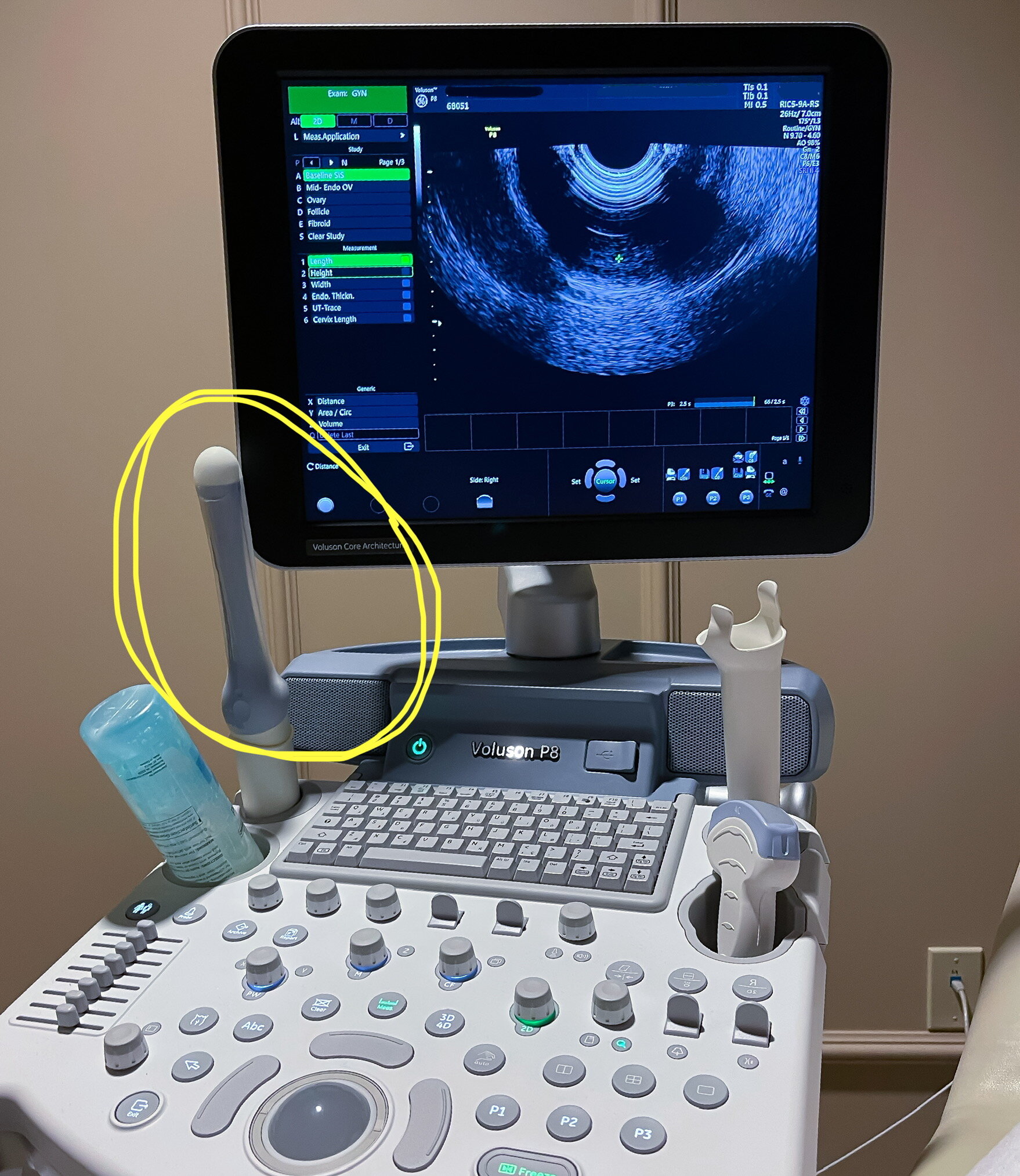 Blog 2 of 6: "You Want To Put That Where?" 