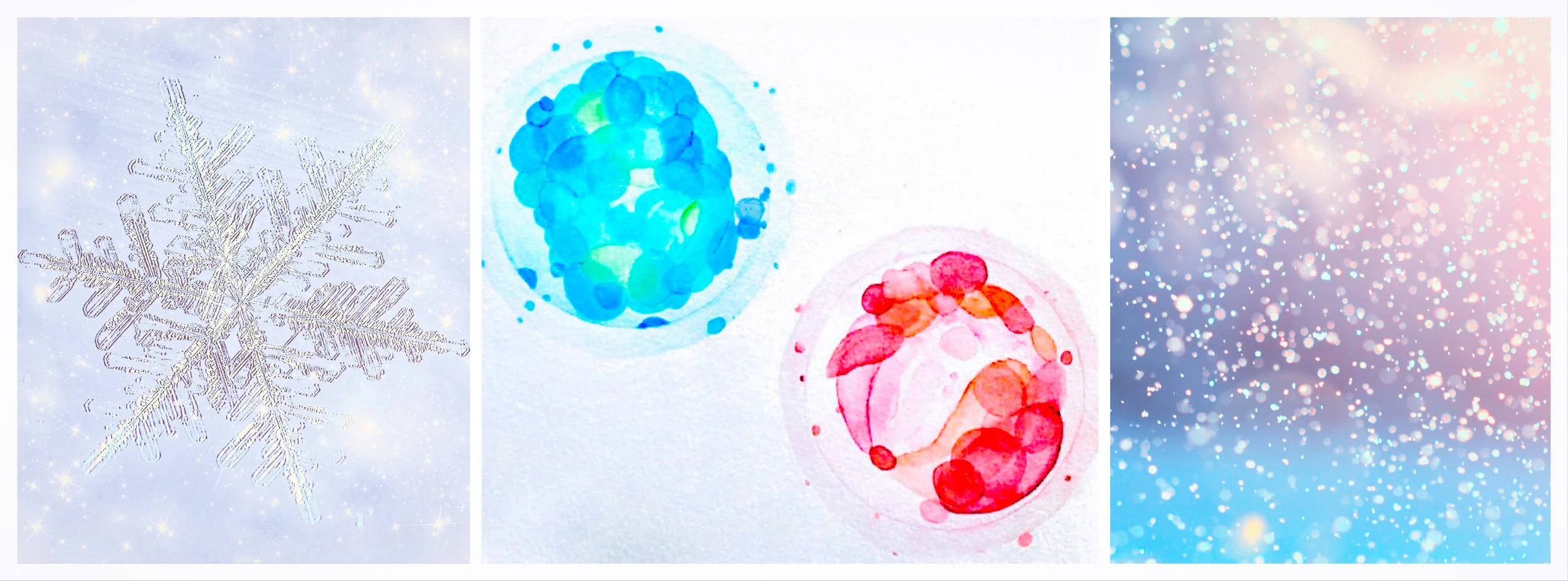 Blog 4 of 6: Options 