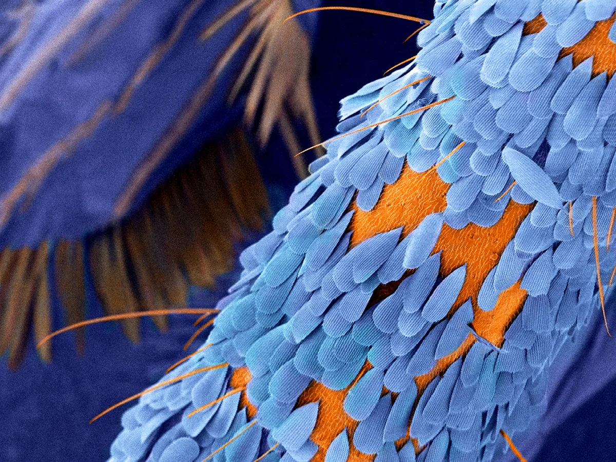 Langley Anderson, microscopy and an interview