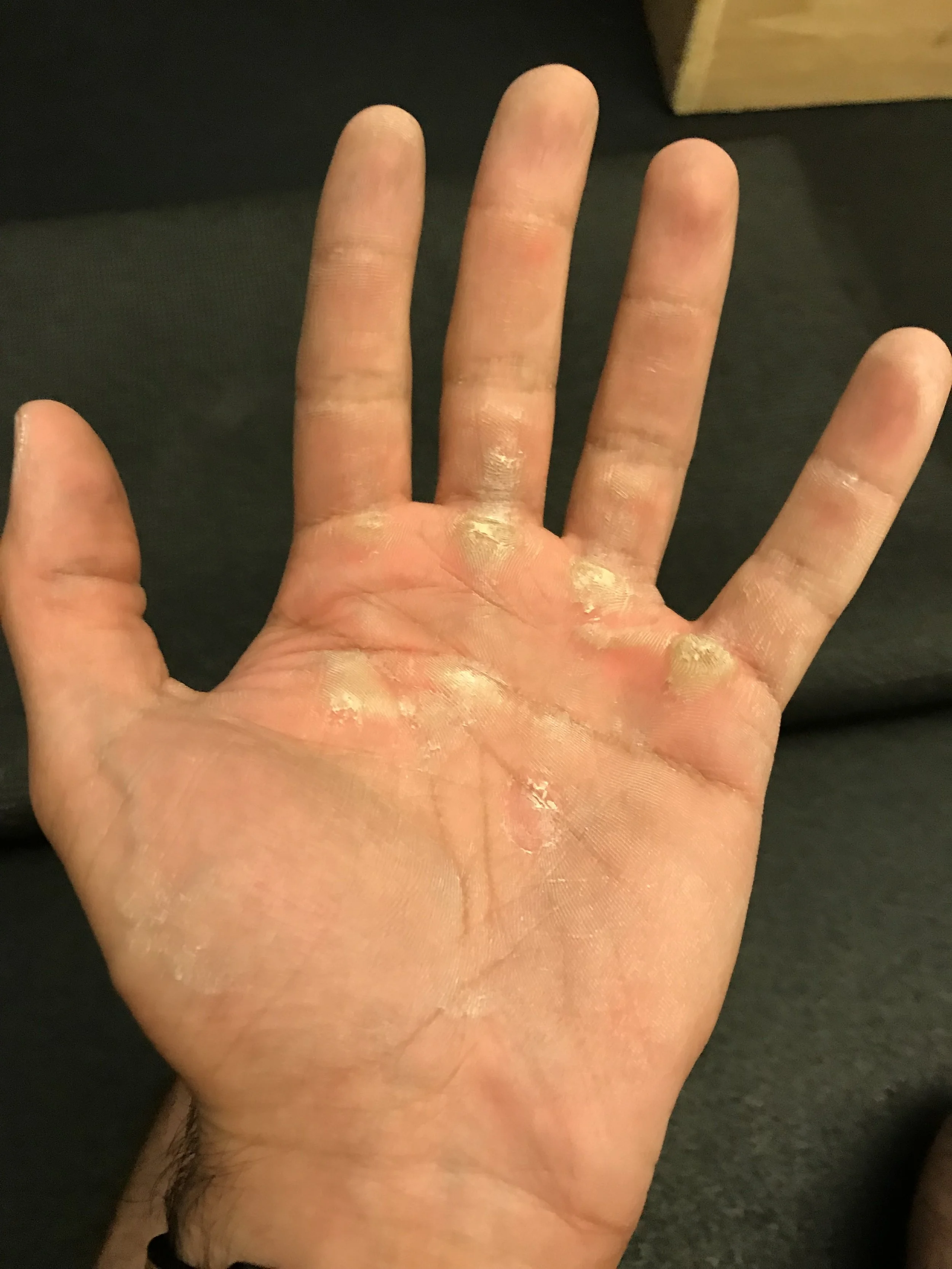 Caring for Your Hands