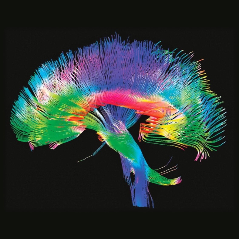 Neural Pathway Intensity