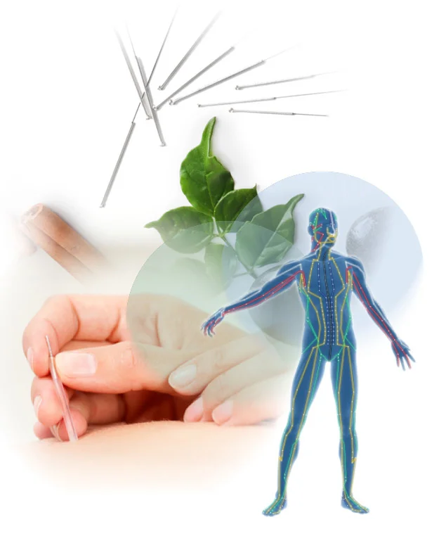 JodiSnider-Services-Acupuncture-1.jpg