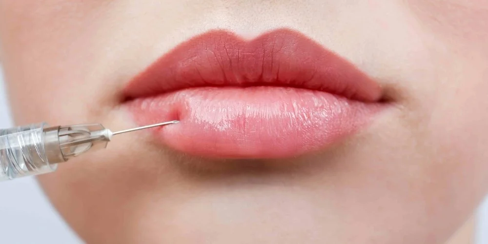 Lip Filler Appointments in Ellicott City, MD for Natural Lip Enhancement and Definition