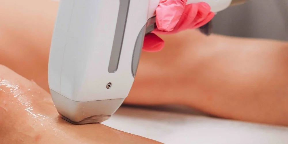 Best Laser Hair Removal Appointments in Columbia MD for Smooth Long-Lasting Results