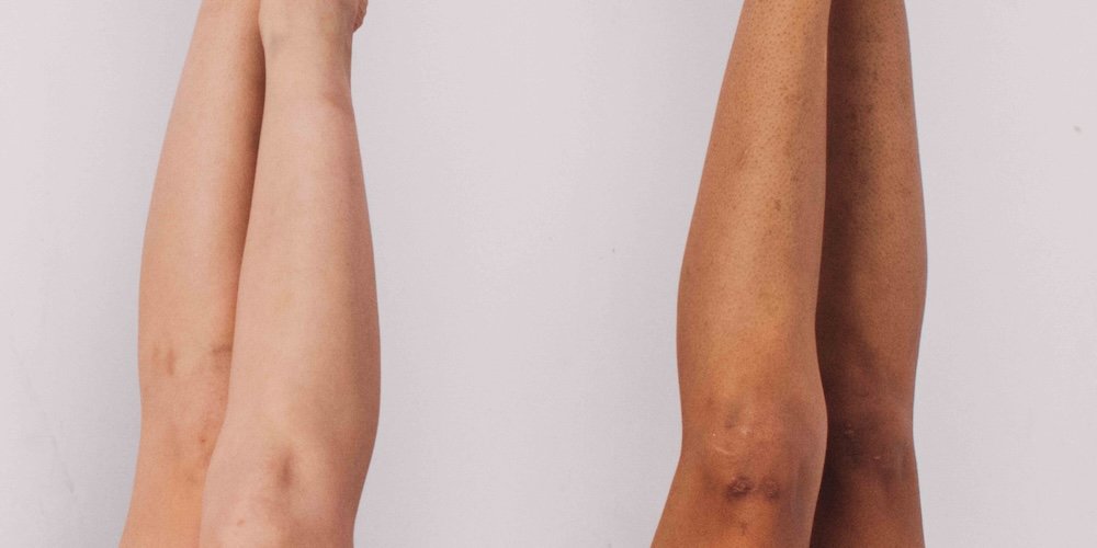 Laser Hair Removal for Indian Skin Types Near Columbia, MD