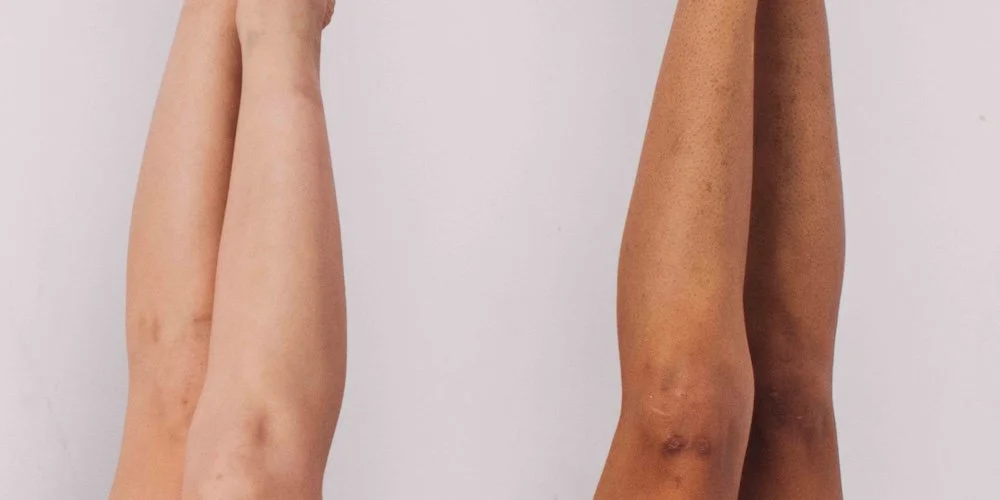 Laser Hair Removal for Indian Skin Types Near Columbia MD