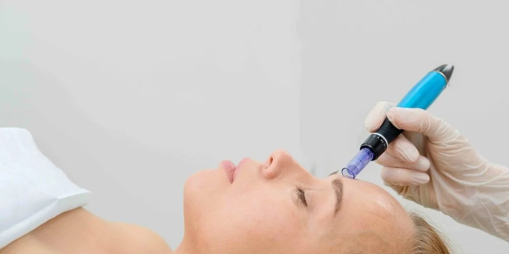 Refresh Your Complexion With Microneedling Treatments Near Elkridge, MD