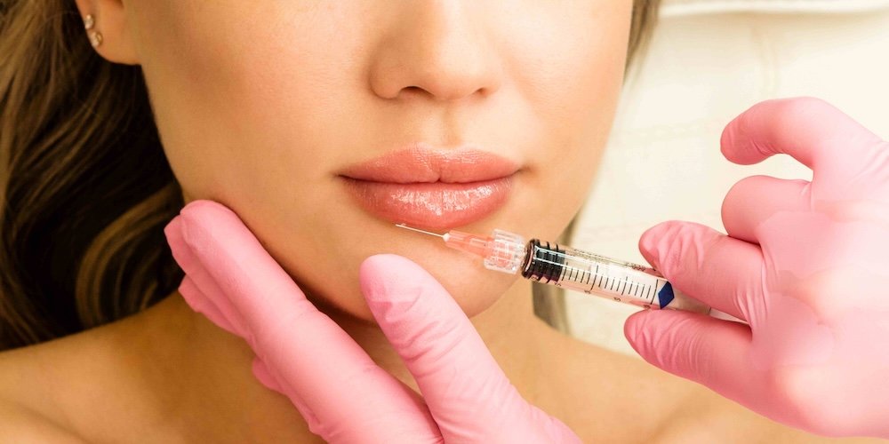 Mini Lip Filler Cost in Clarksville MD for Natural Results