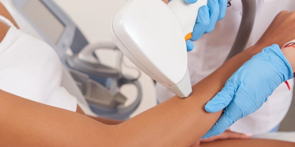 Laser Hair Removal for Dark Skin in Columbia, MD: What Are the Safest Laser Options for Melanin-Rich Skin?