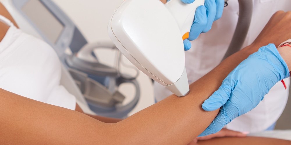 Laser Hair Removal for Dark Skin in Columbia MD