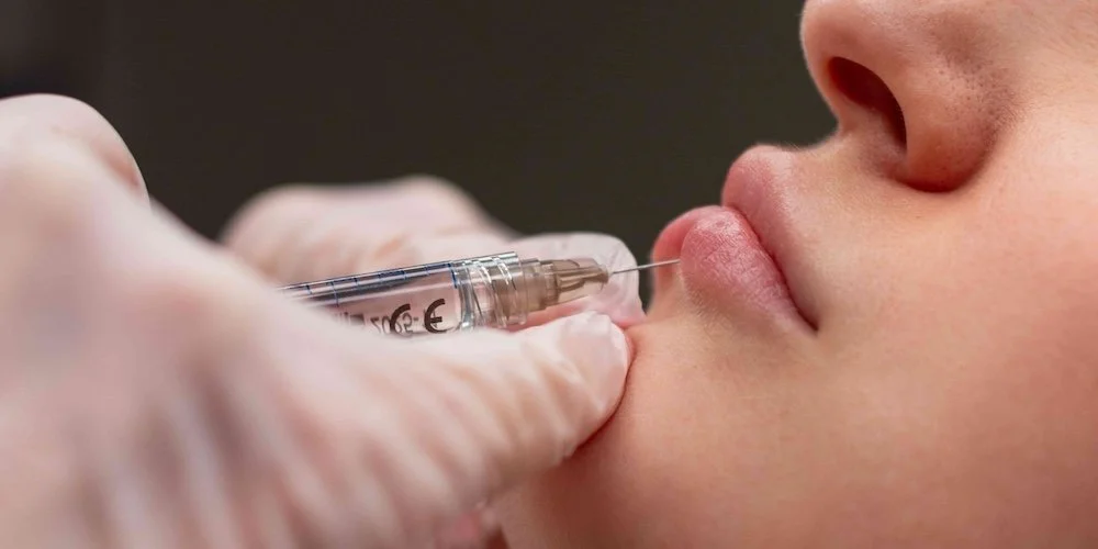 Mini Lip Filler Prices in Howard County, Maryland