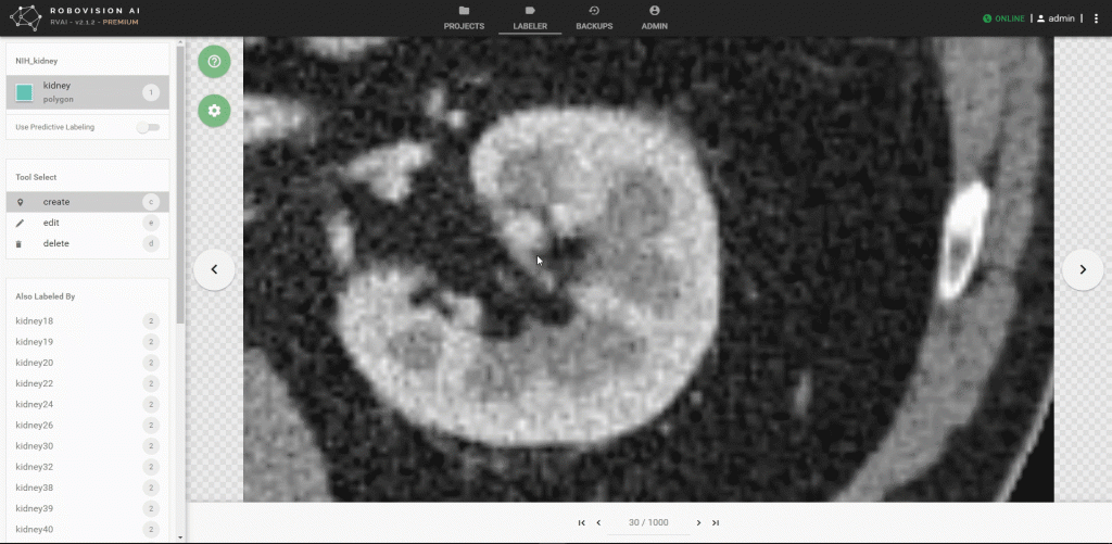 using Robovision’s RVAI platform to label a kidney for automated organ detection.