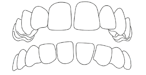 Gapped teeth.jpg