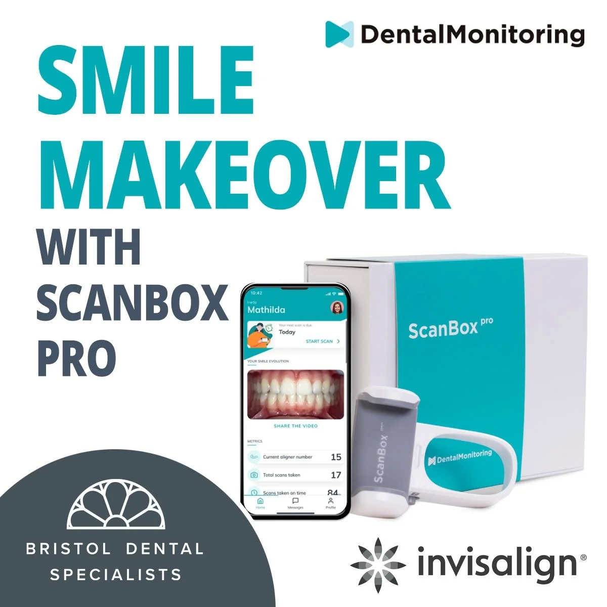 Simply straightening teeth | Bristol Dental Specialists