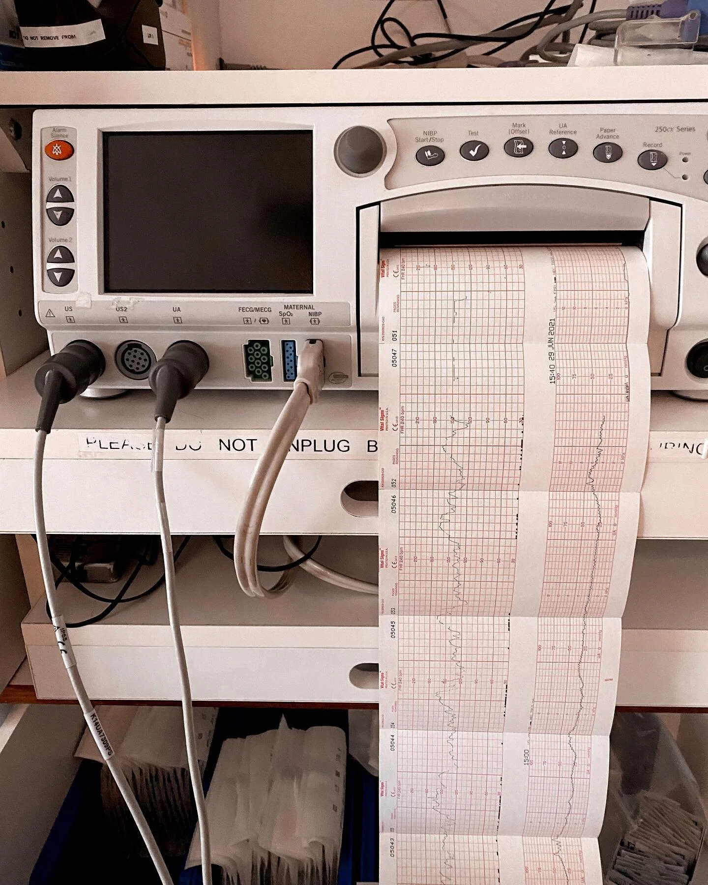 Birth has a rhythm.
~
This rhythm, and these patterns can be seen on electronic fetal monitoring (EFM) tracings, like shown in this photo. But these rhythms are identifiable without continuous EFM, if you tune into your intuitive self.
~
Yes, surges 